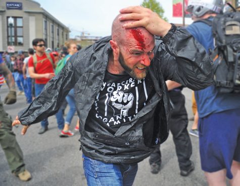 Anti-Trump protester Cole, who refused to give his last name or city of residence, holds his bleeding head as he runs away from a fight that broke out in the crowd during a pro-Trump rally in Berkeley, California on Saturday, April 15, 2017. The Patriots Day rally, which started at Martin Luther King Jr. Civic Center Park, escalated to a street fight on Center Street after provocations from both sides erupted into clashes. 